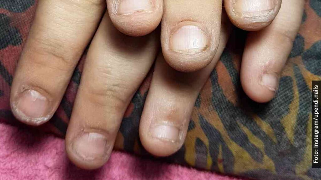 me como las uñas
